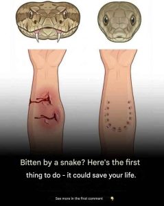 Bitten by a snake? Here's the first thing to do — it could save your life