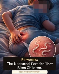 Pinworms in Children: What They Are and Why They Cause Nighttime Itching.